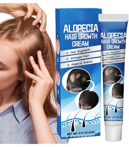 Alopecia Gel 4パック Alopecia Amazing Hair Growth by Alopecia : Amazon.co.uk: Beauty